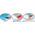 MAX HD-10V Flexible Stapler - 15 sheets Capacity (BLUE) (Item No: B07-26BL) A1R2B257